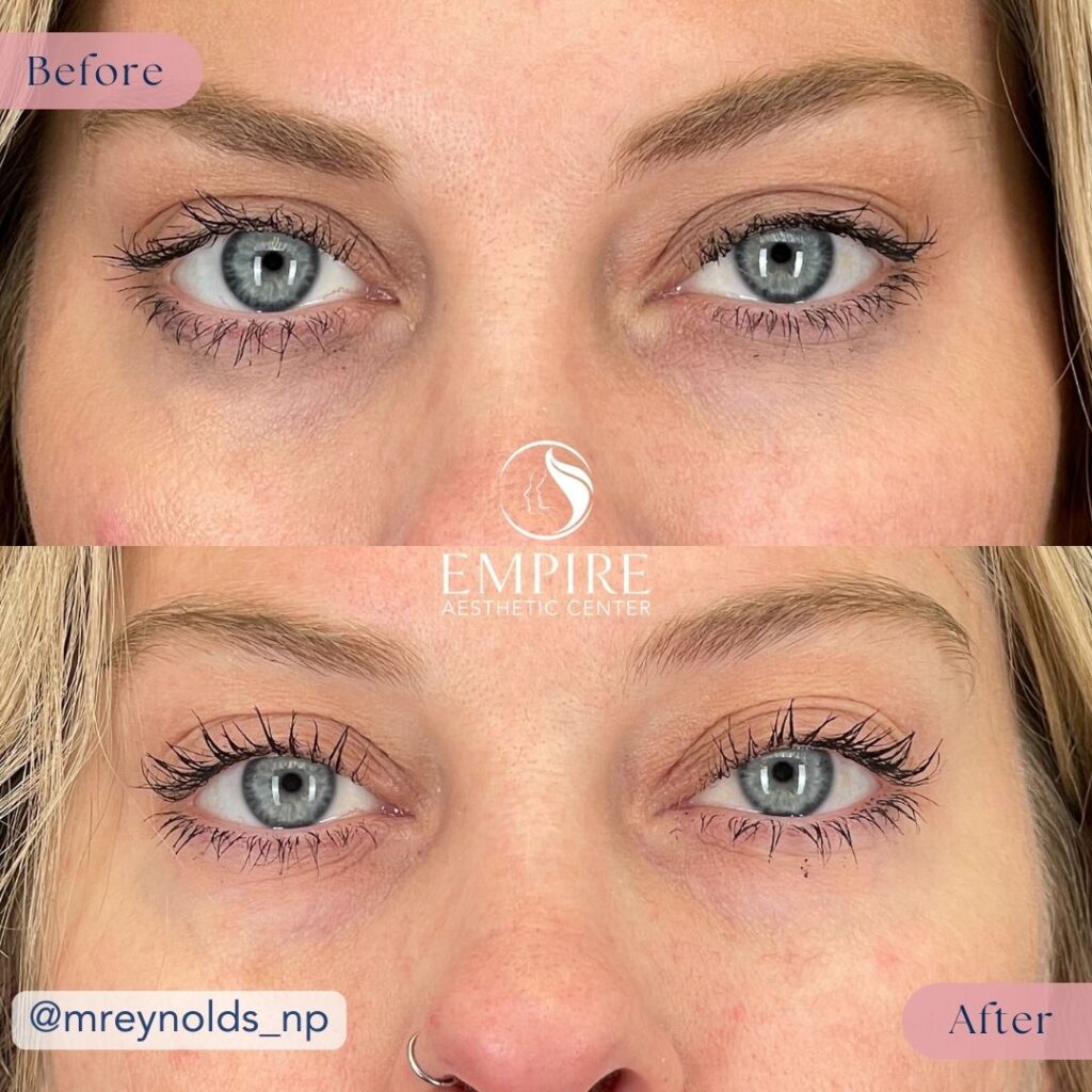 EZ Gel Before and After in Bakersfield