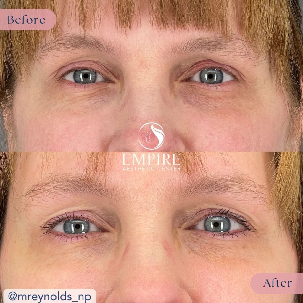 EZ Gel Before and After in Bakersfield