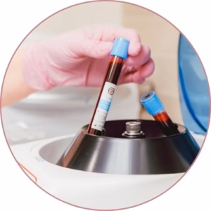 Get Microneedling with Growth Factor Therapy in Bakersfield at Empire Aesthetic Center